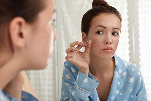 MT Skin CLINIC-Hydrocolloid Acne flasteri - Pimple flasteri za lice - 72 pc Acne Treatment for Face-sa uljem čajevca-Blemish Spot Treatment - Acne Stickers for Face